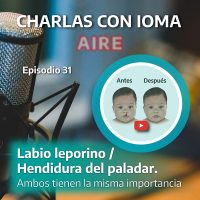 Episodio 31: Labio Leporino y Hendidura del paladar 